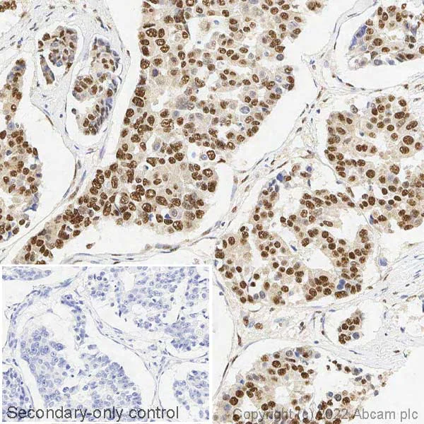 Immunohistochemistry (Formalin/PFA-fixed paraffin-embedded sections) - Anti-SNAIL + SLUG antibody (AB85936)
