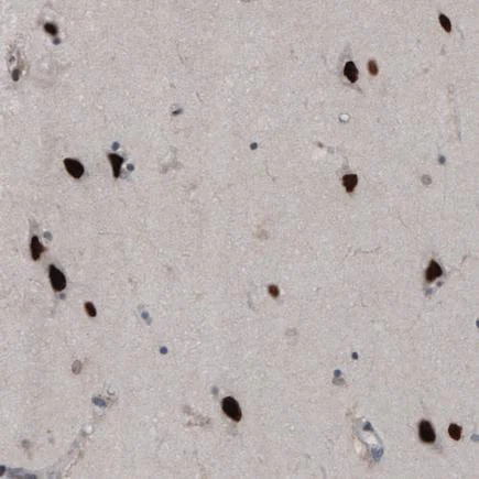 Immunohistochemistry (Formalin/PFA-fixed paraffin-embedded sections) - Anti-SNAIL + SLUG antibody [CL3700] - N-terminal (AB224731)