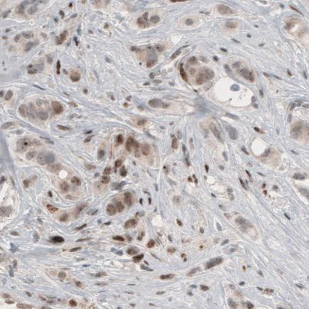 Anti-SNAIL + SLUG antibody [CL3700] - N-terminal (ab224731