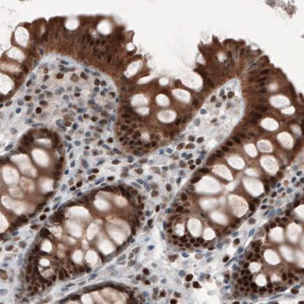 Immunohistochemistry (Formalin/PFA-fixed paraffin-embedded sections) - Anti-SNAIL + SLUG antibody [CL3700] - N-terminal (AB224731)