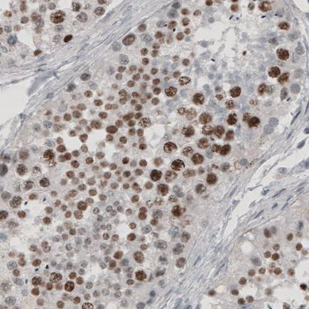 Immunohistochemistry (Formalin/PFA-fixed paraffin-embedded sections) - Anti-SNAIL + SLUG antibody [CL3700] - N-terminal (AB224731)