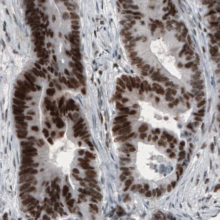 Immunohistochemistry (Formalin/PFA-fixed paraffin-embedded sections) - Anti-SNAIL + SLUG antibody [CL3700] - N-terminal (AB224731)