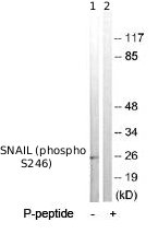 Western blot - Anti-SNAIL + SLUG (phospho S246) antibody (AB63568), expandable thumbnail