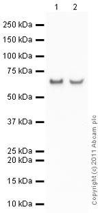 Western blot - Anti-SNAIL + SLUG (phospho S246) antibody (AB63568), expandable thumbnail