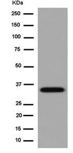 Western blot - Anti-SNAP-beta antibody [EPR15046(B)] - BSA and Azide free (AB250764)
