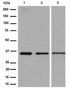 Western blot - Anti-SNAP-beta antibody [EPR15046(B)] - BSA and Azide free (AB250764)