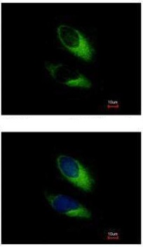 Immunocytochemistry/ Immunofluorescence - Anti-SNAP23 antibody (AB229085)