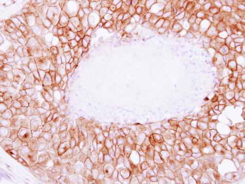 Immunohistochemistry (Formalin/PFA-fixed paraffin-embedded sections) - Anti-SNAP23 antibody (AB229085)