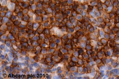 Immunohistochemistry (Formalin/PFA-fixed paraffin-embedded sections) - Anti-SNAP23 antibody (AB3340)
