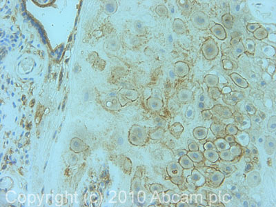 Immunohistochemistry (Formalin/PFA-fixed paraffin-embedded sections) - Anti-SNAP23 antibody (AB4114)