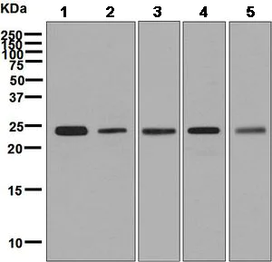 Western blot - Anti-SNAP23 antibody [EPR8538] (AB131242)