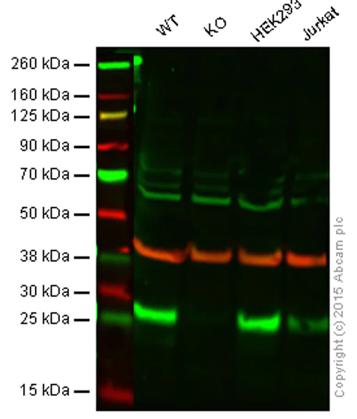 Western blot - Anti-SNAP23 antibody [EPR8538] (AB131242)