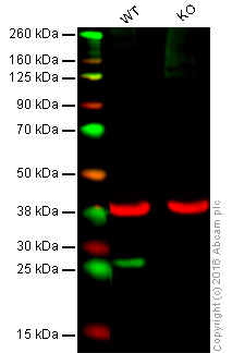 Western blot - Anti-SNAP23 antibody [EPR8539] (AB133703), expandable thumbnail