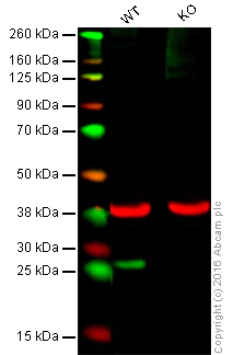 Western blot - Anti-SNAP23 antibody [EPR8539] (AB133703)