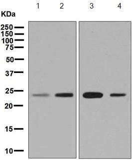 Western blot - Anti-SNAP23 antibody [EPR8539] (AB133703), expandable thumbnail