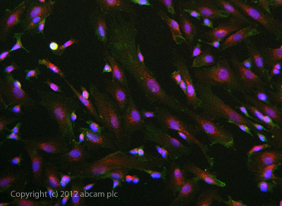 Immunocytochemistry/ Immunofluorescence - Anti-SNAP25 antibody [4A3] (AB66066)