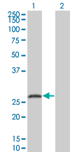 Western blot - Anti-SNAP25 antibody [4A3] (AB66066)