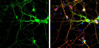 Immunocytochemistry/ Immunofluorescence - Anti-SNAP25 antibody (AB228880)