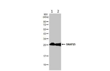Western blot - Anti-SNAP25 antibody (AB228880)