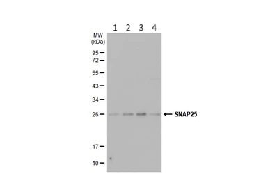 Western blot - Anti-SNAP25 antibody (AB228880)