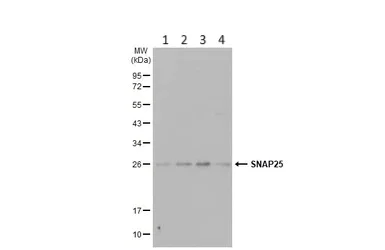 Western blot - Anti-SNAP25 antibody (AB228880)