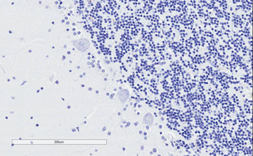 Immunohistochemistry (Formalin/PFA-fixed paraffin-embedded sections) - Anti-SNAP25 antibody (AB31281)