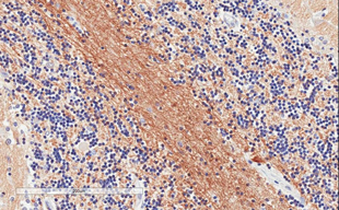 Immunohistochemistry (Formalin/PFA-fixed paraffin-embedded sections) - Anti-SNAP25 antibody (AB31281)