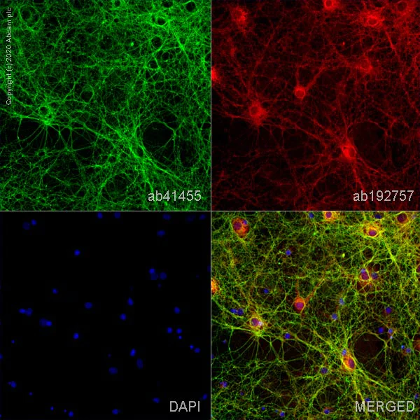 Immunocytochemistry - Anti-SNAP25 antibody (AB41455)