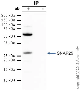 Immunoprecipitation - Anti-SNAP25 antibody (AB41455)