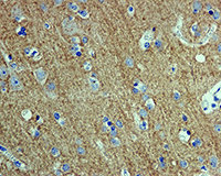 Immunohistochemistry (Formalin/PFA-fixed paraffin-embedded sections) - Anti-SNAP25 antibody [EP3274] (AB108990), expandable thumbnail