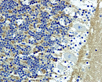 Immunohistochemistry (Formalin/PFA-fixed paraffin-embedded sections) - Anti-SNAP25 antibody [EP3274] (AB108990), expandable thumbnail