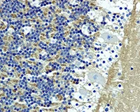 Immunohistochemistry (Formalin/PFA-fixed paraffin-embedded sections) - Anti-SNAP25 antibody [EP3274] (AB108990)