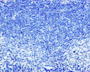 Immunohistochemistry (Formalin/PFA-fixed paraffin-embedded sections) - Anti-SNAP25 antibody [EP3274] (AB108990)