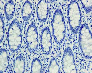 Immunohistochemistry (Formalin/PFA-fixed paraffin-embedded sections) - Anti-SNAP25 antibody [EP3274] (ab108990), expandable thumbnail
