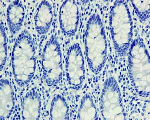 Immunohistochemistry (Formalin/PFA-fixed paraffin-embedded sections) - Anti-SNAP25 antibody [EP3274] (AB108990)