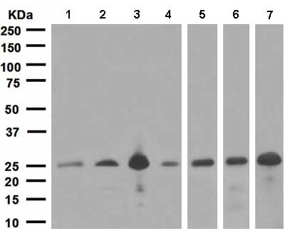 Western blot - Anti-SNAP25 antibody [EP3274] (AB108990), expandable thumbnail