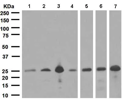 Western blot - Anti-SNAP25 antibody [EP3274] (AB108990)
