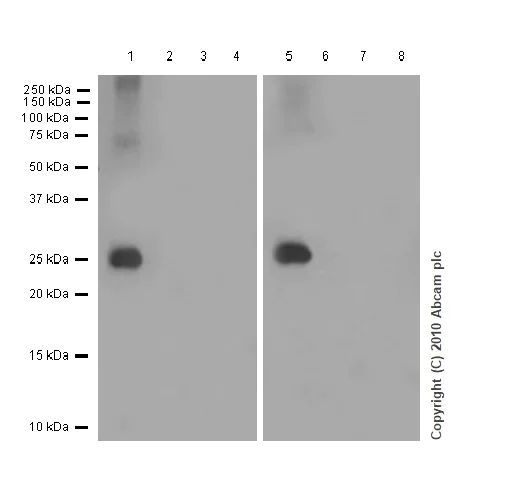 Western blot - Anti-SNAP25 antibody [EP3274] (AB108990)