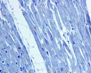 Immunohistochemistry (Formalin/PFA-fixed paraffin-embedded sections) - Anti-SNAP25 antibody [EP3274] - BSA and Azide free (AB226046)