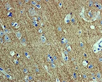 Immunohistochemistry (Formalin/PFA-fixed paraffin-embedded sections) - Anti-SNAP25 antibody [EP3274] - BSA and Azide free (AB226046)