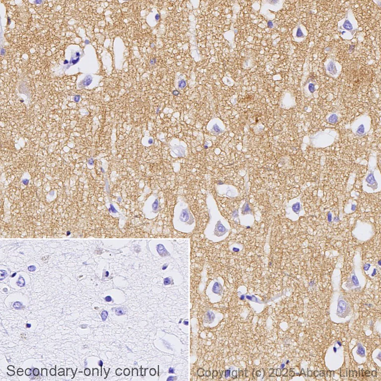 Immunohistochemistry (Formalin/PFA-fixed paraffin-embedded sections) - Anti-SNAP25 antibody [EP3274] - BSA and Azide free (AB226046)