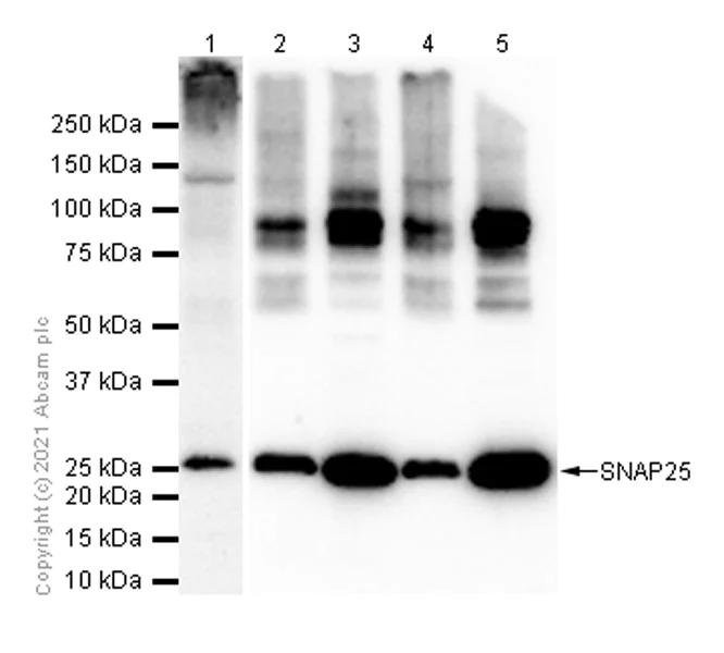 Western blot - Anti-SNAP25 antibody [EPR3275] - BSA and Azide free (AB171355)