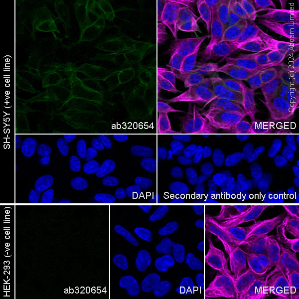 Immunocytochemistry/ Immunofluorescence - Anti-SNAP25 antibody [RM1207] (AB320654)