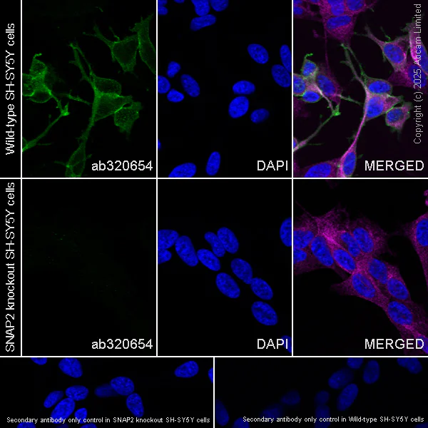 Immunocytochemistry/ Immunofluorescence - Anti-SNAP25 antibody [RM1207] (AB320654)