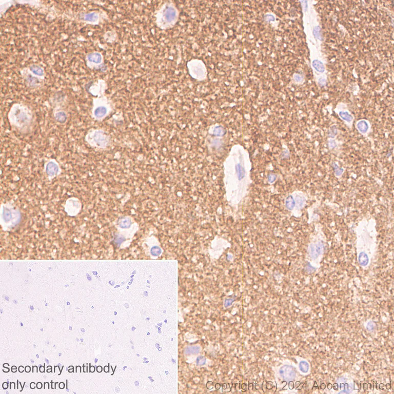 Immunohistochemistry (Formalin/PFA-fixed paraffin-embedded sections) - Anti-SNAP25 antibody [RM1207] (AB320654)