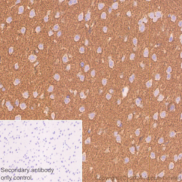 Immunohistochemistry (Formalin/PFA-fixed paraffin-embedded sections) - Anti-SNAP25 antibody [RM1207] (AB320654)