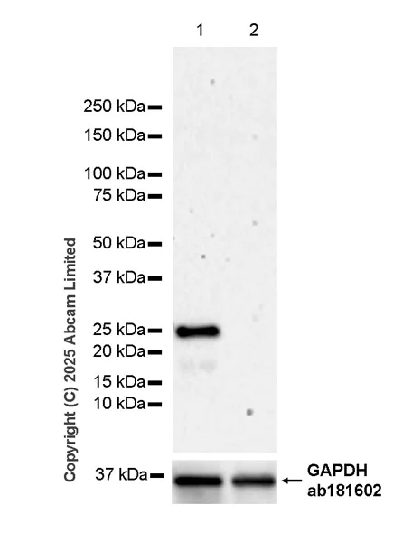 Western blot - Anti-SNAP25 antibody [RM1207] (AB320654)