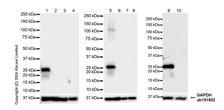 Western blot - Anti-SNAP25 antibody [RM1207] - BSA and Azide free (AB320655)