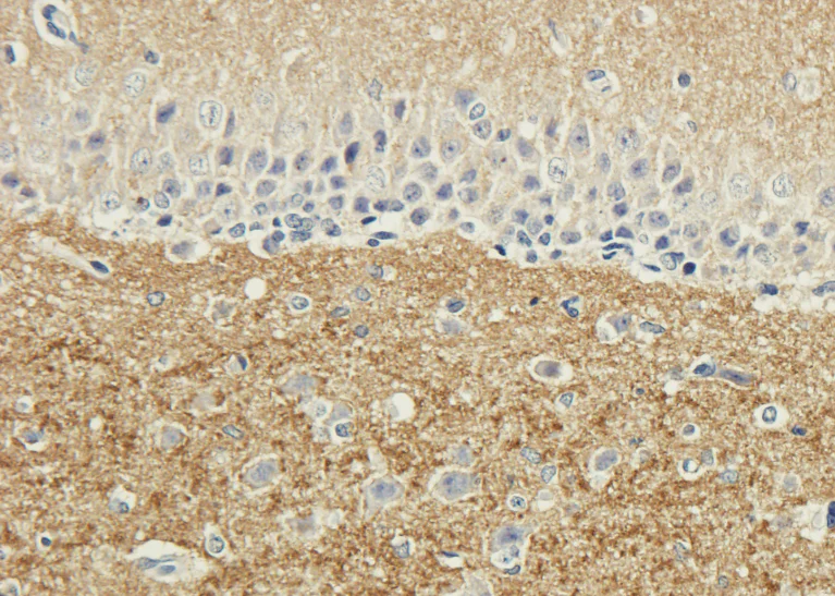 Immunohistochemistry (Formalin/PFA-fixed paraffin-embedded sections) - Anti-SNAP25 antibody [SP12] (AB288428)