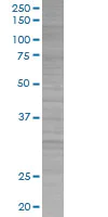 SDS-PAGE - SNAP25 overexpression 293T lysate (whole cell) (AB94226)